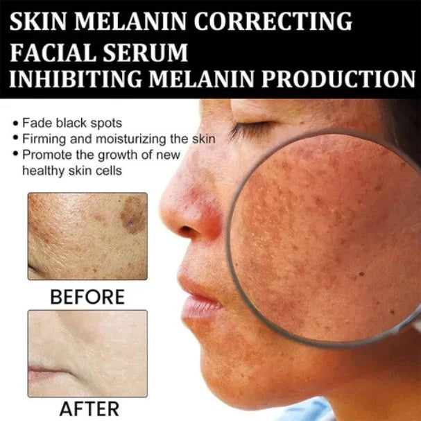 Eelhoe Melanin Correcting Serum – Dark Spot & Skin Tone Corrector