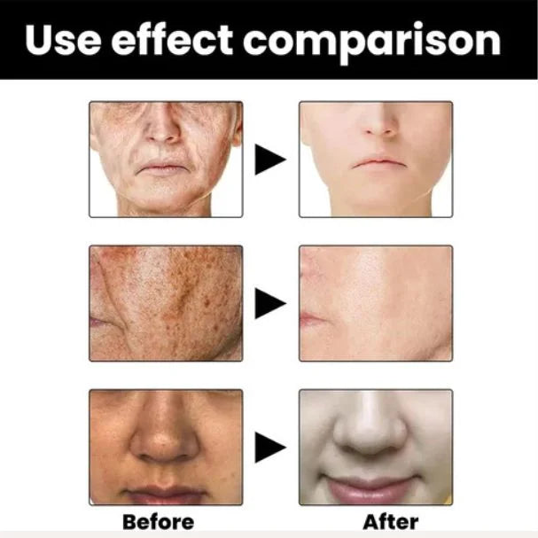 Eelhoe Melanin Correcting Serum – Dark Spot & Skin Tone Corrector