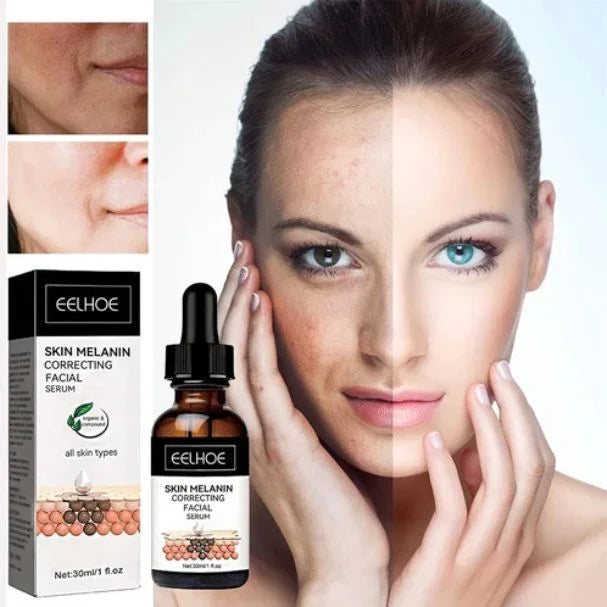 Eelhoe Melanin Correcting Serum – Dark Spot & Skin Tone Corrector